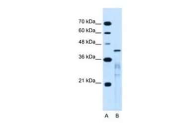 Anti-MARVELD3 antibody, Internal used in Western Blot (WB). GTX46649
