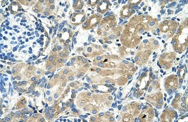 Anti-TM9SF1 antibody, Internal used in IHC (Paraffin sections) (IHC-P). GTX46657