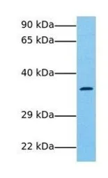 Anti-LECT1 antibody, N-term used in Western Blot (WB). GTX46674