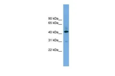 Anti-B4GALT2 antibody, Internal used in Western Blot (WB). GTX46702