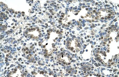 Anti-GPNMB antibody, N-term used in IHC (Paraffin sections) (IHC-P). GTX46707