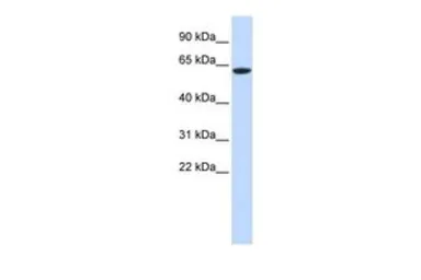 Anti-LINGO4 antibody, Internal used in Western Blot (WB). GTX46712