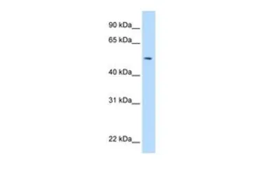 Anti-NEU1 antibody, Internal used in Western Blot (WB). GTX46743