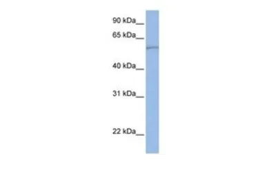 Anti-SLC22A11 antibody, C-term used in Western Blot (WB). GTX46805
