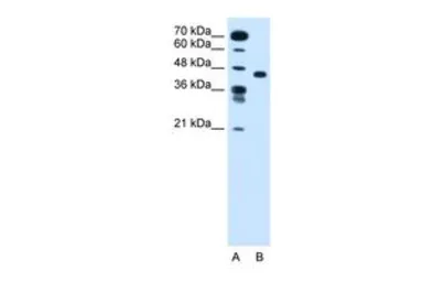 Anti-SLC35C1 antibody, N-term used in Western Blot (WB). GTX46808