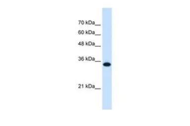 Anti-SLC25A38 antibody, Internal used in Western Blot (WB). GTX46811