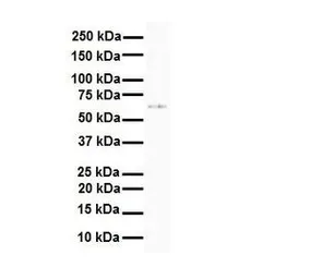 Anti-SLC7A1 antibody, N-term used in Western Blot (WB). GTX46841