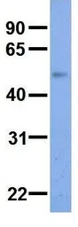 Anti-SLC37A4 antibody, Internal used in Western Blot (WB). GTX46845
