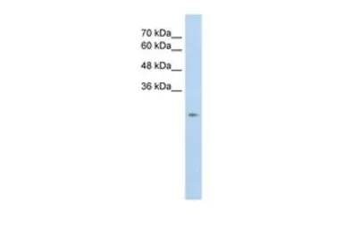 Anti-SLC25A45 antibody, C-term used in Western Blot (WB). GTX46850