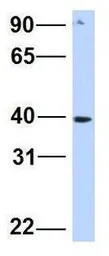 Anti-SNTB1 antibody, N-term used in Western Blot (WB). GTX46866