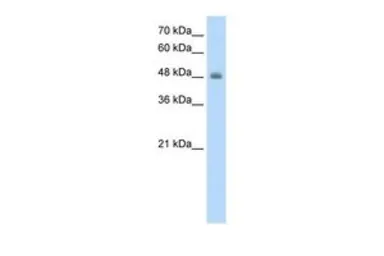 Anti-RNF128 antibody, C-term used in Western Blot (WB). GTX46906