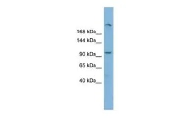 Anti-HERC4 antibody, Internal used in Western Blot (WB). GTX46908