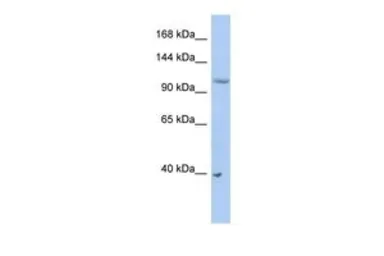 Anti-NEDD4L antibody, Internal used in Western Blot (WB). GTX46924