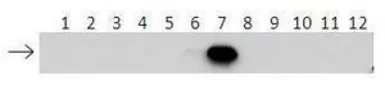 Anti-UBE2E3 antibody, N-term used in Western Blot (WB). GTX46934