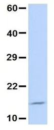 Anti-UBE2D3 antibody, N-term used in Western Blot (WB). GTX46939