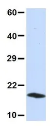 Anti-UBE2D3 antibody, N-term used in Western Blot (WB). GTX46939