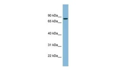 Anti-EPB41 antibody, N-term used in Western Blot (WB). GTX46961