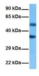 Anti-SLC19A3 antibody, Internal used in Western Blot (WB). GTX46980