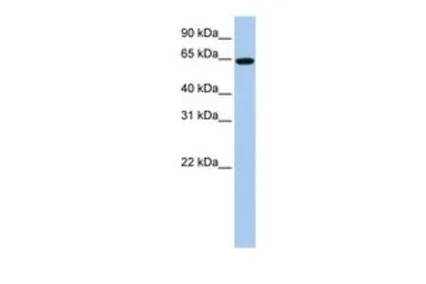 Anti-EPS8L1 antibody, Internal used in Western Blot (WB). GTX47008