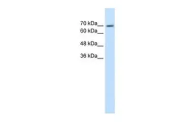 Anti-EPS8L1 antibody, N-term used in Western Blot (WB). GTX47009