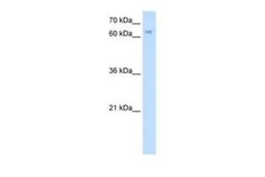 Anti-ESRP1 antibody, N-term used in Western Blot (WB). GTX47010