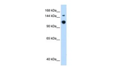 Anti-GAPVD1 antibody, N-term used in Western Blot (WB). GTX47022