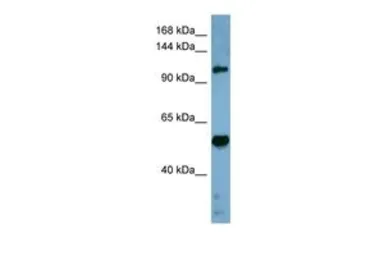 Anti-COBLL1 antibody, Internal used in Western Blot (WB). GTX47027
