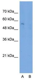 Anti-SLC22A7 antibody, N-term used in Western Blot (WB). GTX47049