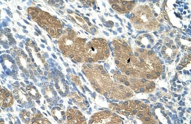 Anti-SLC1A5 antibody, Internal used in IHC (Paraffin sections) (IHC-P). GTX47058