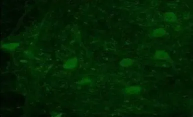 Anti-SERCA1 ATPase antibody, N-term used in IHC (Paraffin sections) (IHC-P). GTX47068