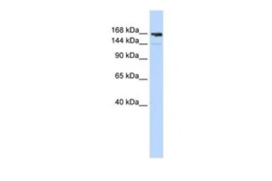 Anti-Periplakin antibody, Internal used in Western Blot (WB). GTX47089