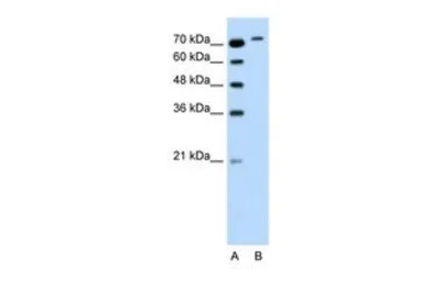 Anti-RHOBTB1 antibody, Internal used in Western Blot (WB). GTX47103