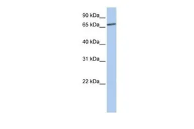 Anti-LSS antibody, N-term used in Western Blot (WB). GTX47109