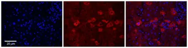 Anti-CYP4F3 antibody, N-term used in IHC (Paraffin sections) (IHC-P). GTX47110