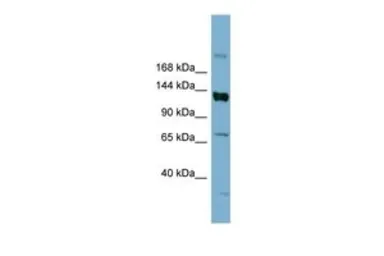 Anti-ABCB4 antibody, Internal used in Western Blot (WB). GTX47122