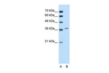 Anti-ALAD antibody, Internal used in Western Blot (WB). GTX47128