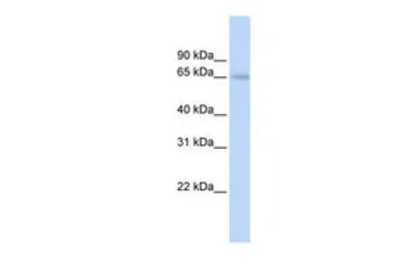 Anti-SLC22A6 antibody, C-term used in Western Blot (WB). GTX47147