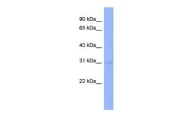 Anti-Claudin 18 antibody, Internal used in Western Blot (WB). GTX47159