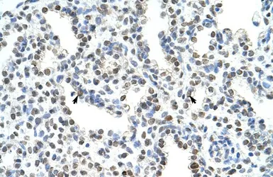 Anti-WDR6 antibody, C-term used in IHC (Paraffin sections) (IHC-P). GTX47169