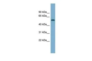 Anti-MFRP antibody, N-term used in Western Blot (WB). GTX47173