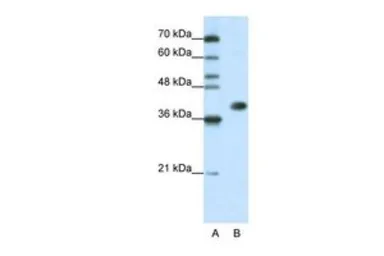 Anti-HNRNPA3 antibody, N-term used in Western Blot (WB). GTX47187