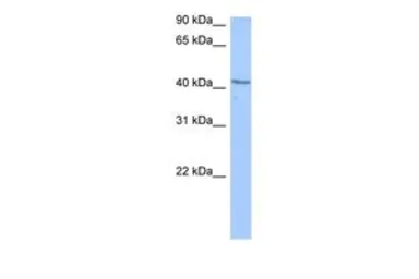 Anti-DCP2 antibody, C-term used in Western Blot (WB). GTX47204