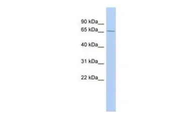 Anti-LARP4 antibody, Internal used in Western Blot (WB). GTX47233