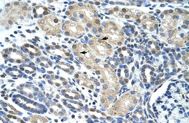 Anti-eIF4H antibody, Internal used in IHC (Paraffin sections) (IHC-P). GTX47262