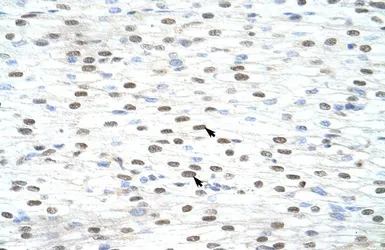 Anti-LSM2 antibody, Internal used in IHC (Paraffin sections) (IHC-P). GTX47264