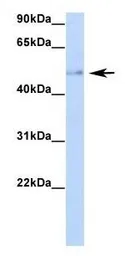 Anti-RBM47 antibody, Internal used in Western Blot (WB). GTX47272