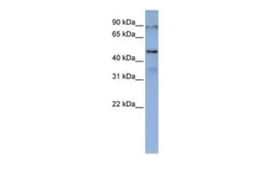 Anti-DAZAP1 antibody, Internal used in Western Blot (WB). GTX47275