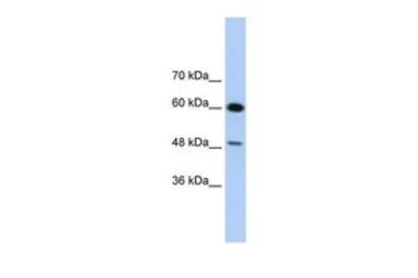 Anti-DAZAP1 antibody, C-term used in Western Blot (WB). GTX47277