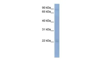 Anti-OAS2 antibody, Internal used in Western Blot (WB). GTX47298