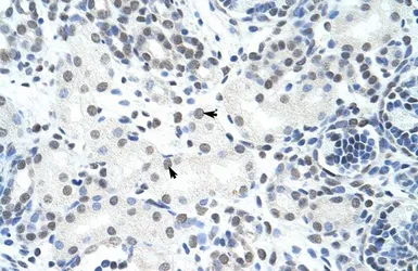 Anti-HNRPH3 antibody, N-term used in IHC (Paraffin sections) (IHC-P). GTX47329